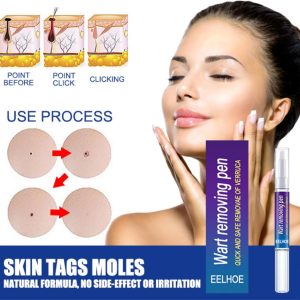 Wart Removing Pen (১টি)