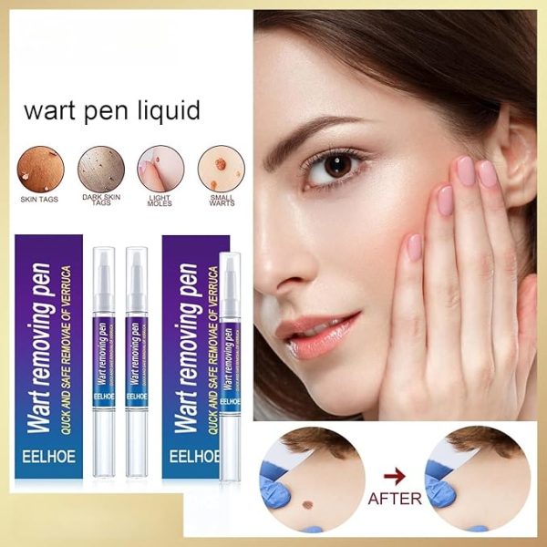 Wart Removing Pen ( 2টি )💥💥